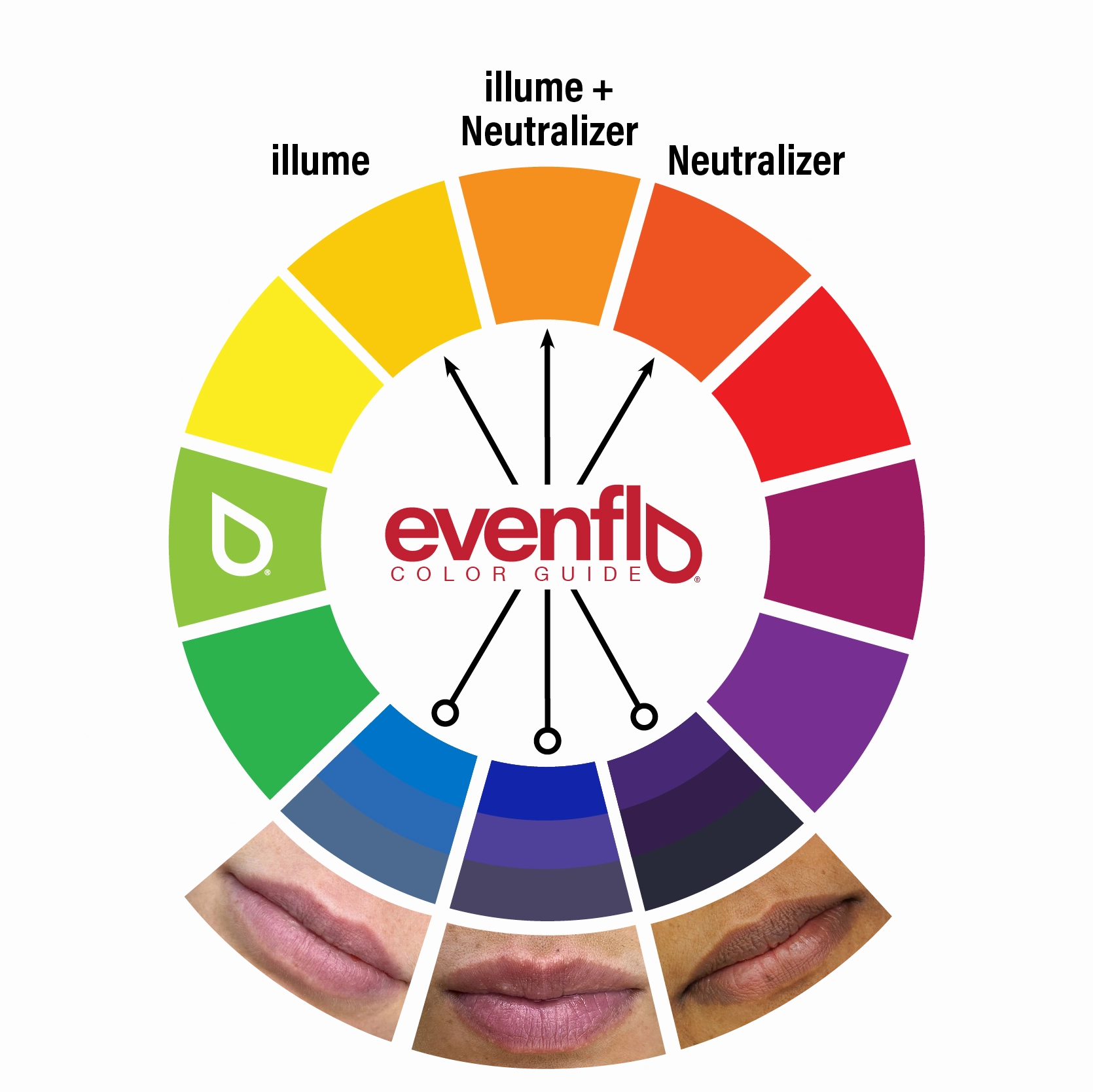 Illume - Evenflo Corrector